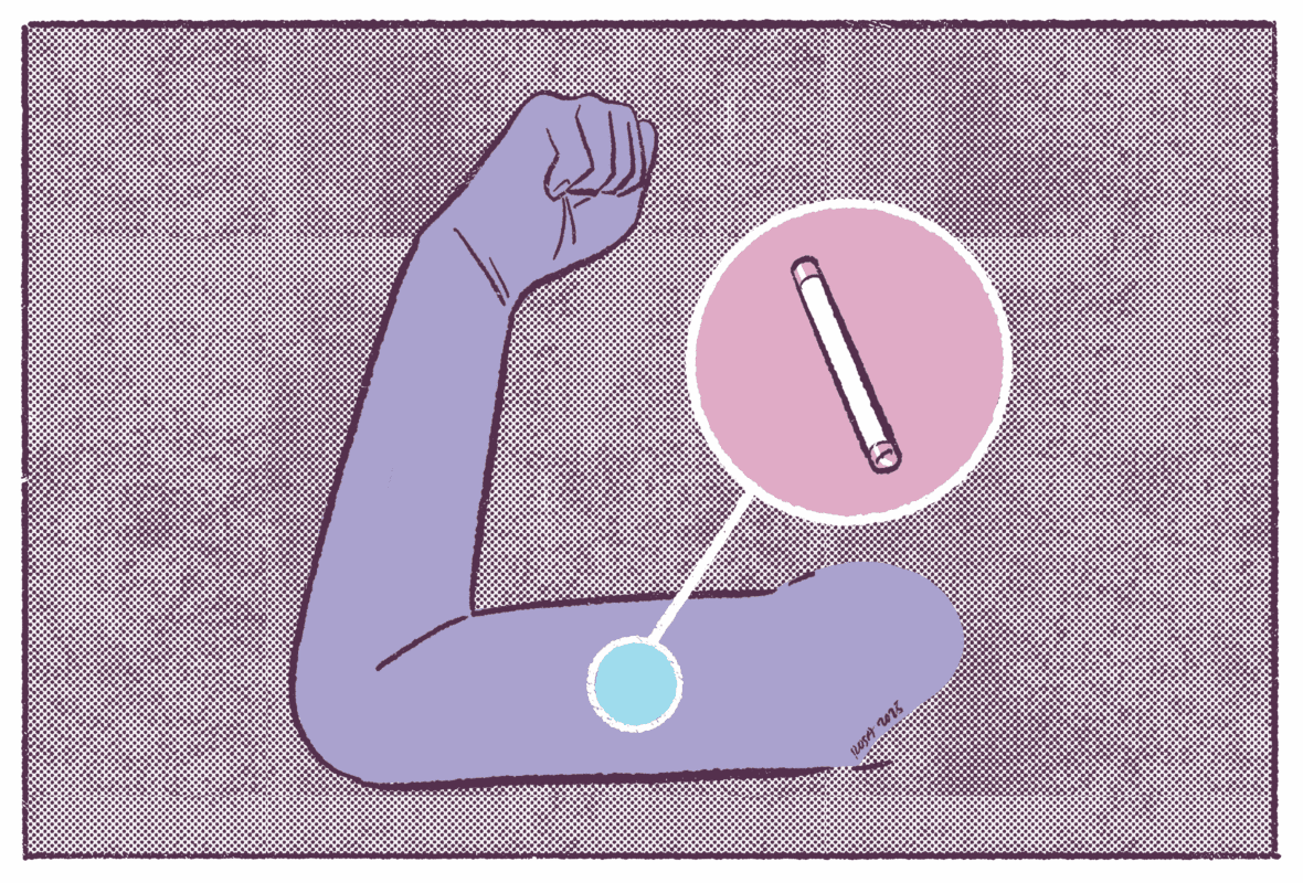 Hablemos de anticonceptivos: el implante.